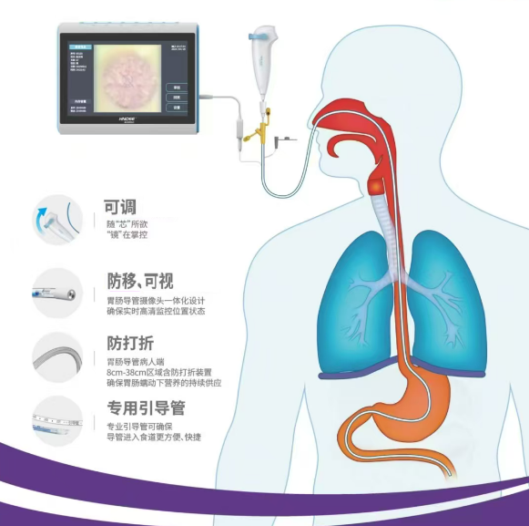 鼻胃肠成像导管及套件